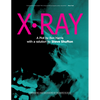 X-Ray by Ben Harris and Steve Shufton - Book